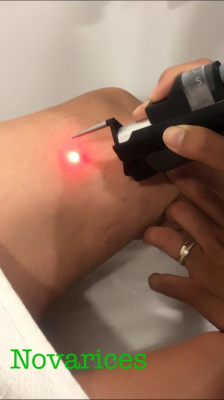 Laser Vascular